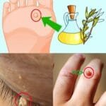 Naturally Addressing Skin Concerns