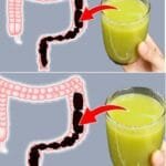 Harnessing the Power of Delicious Beetroot and Lemon Juice for Colon Cleansing and Weight Loss